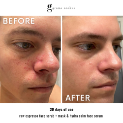 grums hydra calm face serum